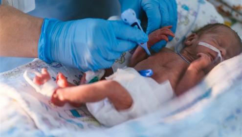 Recém nascido na UTI